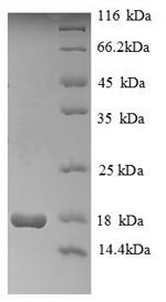 Recombinant Human Histone H2A type 1(HIST1H2AG)