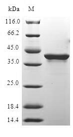 Recombinant Human Histone H2A.x(H2AFX)