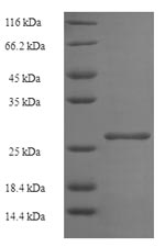 Recombinant Human Histone H2B type 1-B(HIST1H2BB)