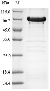 Recombinant Human Histone deacetylase 6(HDAC6),partial