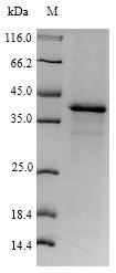 Recombinant Human Histone deacetylase 6(HDAC6),partial