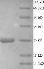 Recombinant Human Histone deacetylase 7(HDAC7),partial