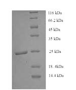 Recombinant Human Histone deacetylase 9(HDAC9) ,partial