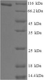 Recombinant Human Holliday junction recognition protein(HJURP)