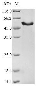 Recombinant Human Homeobox protein Meis3(MEIS3)