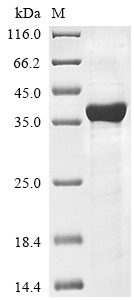 Recombinant Human Hyaluronan and proteoglycan link protein 2(HAPLN2)