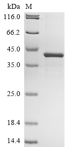 Recombinant Human Hyaluronan and proteoglycan link protein 3(HAPLN3)