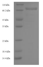 Recombinant Human Hyaluronidase PH-20(SPAM1)
