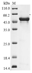 Recombinant Human Hyaluronidase PH-20(SPAM1)