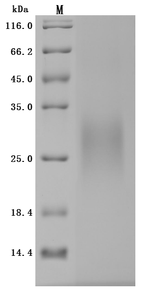 Recombinant Human IGF-like family receptor 1(IGFLR1),partial (Active)