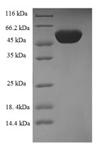 Recombinant Human IgG receptor FcRn large subunit p51(FCGRT),partial