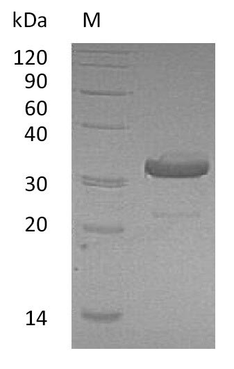 Recombinant Human Immunoglobulin heavy constant gamma 1(IGHG1),partial (Active)