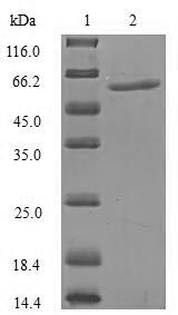 Recombinant Human Importin subunit alpha-5(KPNA1),partial