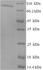 Recombinant Human Inactive N-acetylated-alpha-linked acidic dipeptidase-like protein 2(NAALADL2),partial
