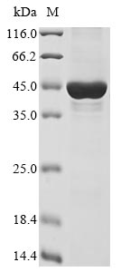 Recombinant Human Inactive histone-lysine N-methyltransferase 2E(KMT2E),partial
