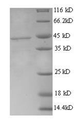 Recombinant Human Inactive tyrosine-protein kinase transmembrane receptor ROR1(ROR1),partial
