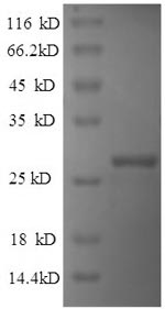 Recombinant Human Indian hedgehog protein(IHH),partial