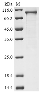 Recombinant Human Inhibitor of nuclear factor kappa-B kinase subunit beta(IKBKB)
