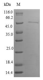 Recombinant Human Inositol hexakisphosphate kinase 1(IP6K1)