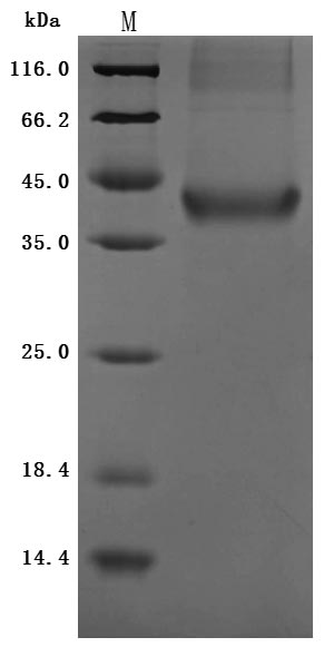 Recombinant Human Insulin growth factor-like family member 1(IGFL1) (Active)