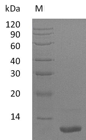 Recombinant Human Insulin-like growth factor I(IGF1) (Active)
