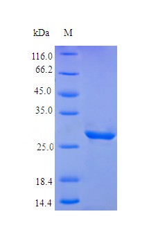 Recombinant Human Insulin-like growth factor-binding protein 3 protein(IGFBP3) (Active)