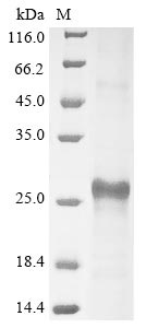 Recombinant Human Insulin-like growth factor-binding protein 3 receptor(TMEM219),partial