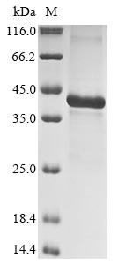 Recombinant Human Insulin-like growth factor-binding protein 5(IGFBP5)