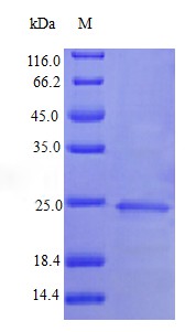 Recombinant Human Interferon alpha-1/13 protein(IFNA1) (Active)