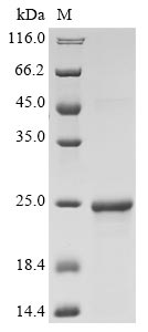 Recombinant Human Interferon alpha-16(IFNA16)