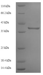 Recombinant Human Interferon alpha/beta receptor 2(IFNAR2),partial