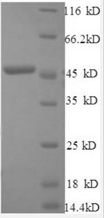 Recombinant Human Interferon beta protein(IFNB1)