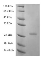Recombinant Human Interferon epsilon(IFNE)