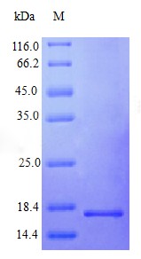 Recombinant Human Interferon gamma protein(IFNG) (Active)
