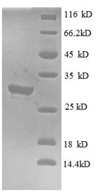 Recombinant Human Interferon-induced transmembrane protein 1(IFITM1) ,partial