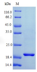 Recombinant Human Interferon lambda-1 protein(IFNL1) (Active)