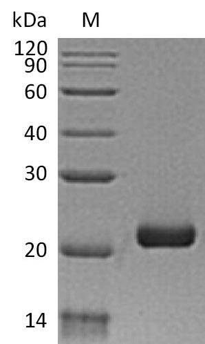 Recombinant Human Interferon lambda-3(IFNL3) (Active)