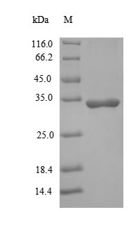 Recombinant Human Interleukin-1 beta(IL1B)