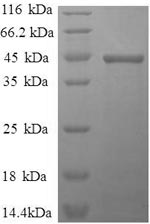 Recombinant Human Interleukin-1 beta(IL1B)