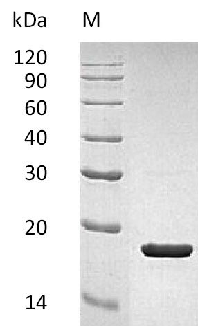 Recombinant Human Interleukin-1 receptor antagonist protein(IL1RN) (Active)