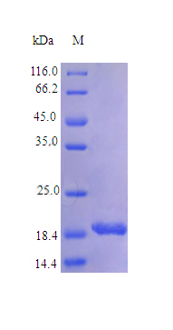Recombinant Human Interleukin-11 protein(IL11) (Active)