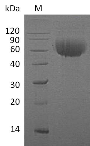 Recombinant Human Interleukin-13 receptor subunit alpha-1(IL13RA1),partial (Active)