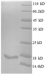 Recombinant Human Interleukin-15(IL15)