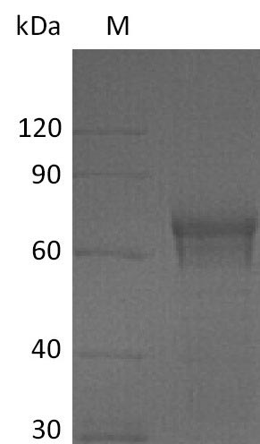 Recombinant Human Interleukin-15 receptor subunit alpha(IL15RA),partial (Active)