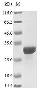 Recombinant Human Interleukin-15 receptor subunit alpha(IL15RA),partial