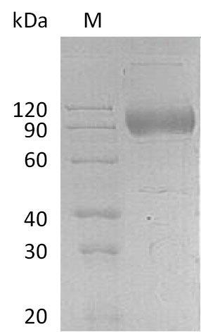 Recombinant Human Interleukin-17 receptor A(IL17RA),partial (Active)