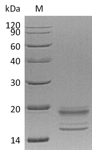 Recombinant Human Interleukin-17A & Interleukin-17F(IL17A & IL17F) (Active)