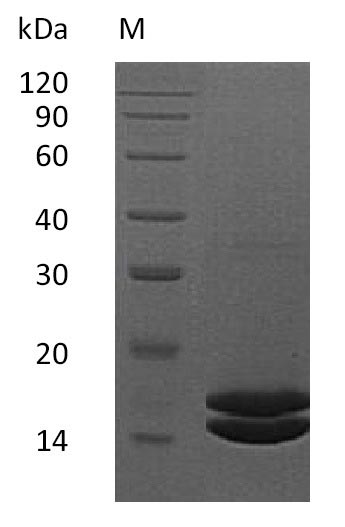 Recombinant Human Interleukin-2(IL2) (Active)