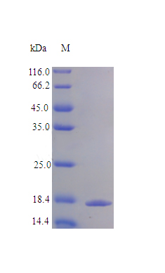 Recombinant Human Interleukin-20 protein(IL20) (Active)