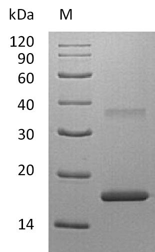 Recombinant Human Interleukin-20 receptor subunit alpha(IL20RA),partial (Active)